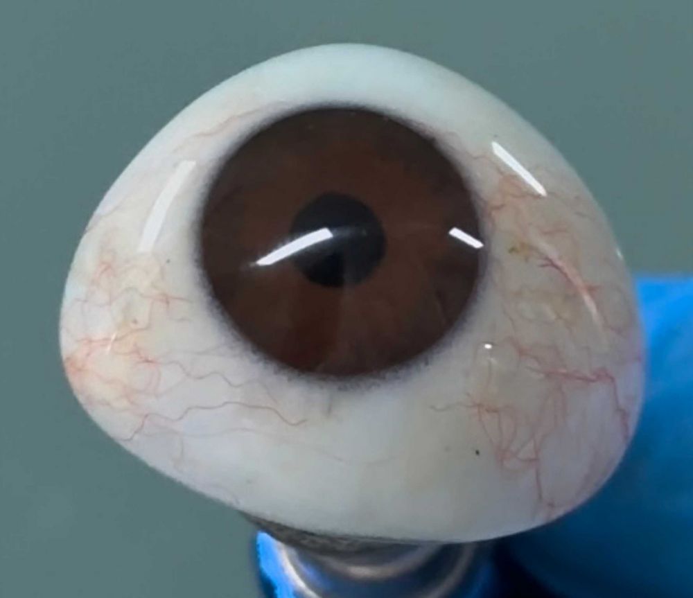 永康哪里义眼做的好