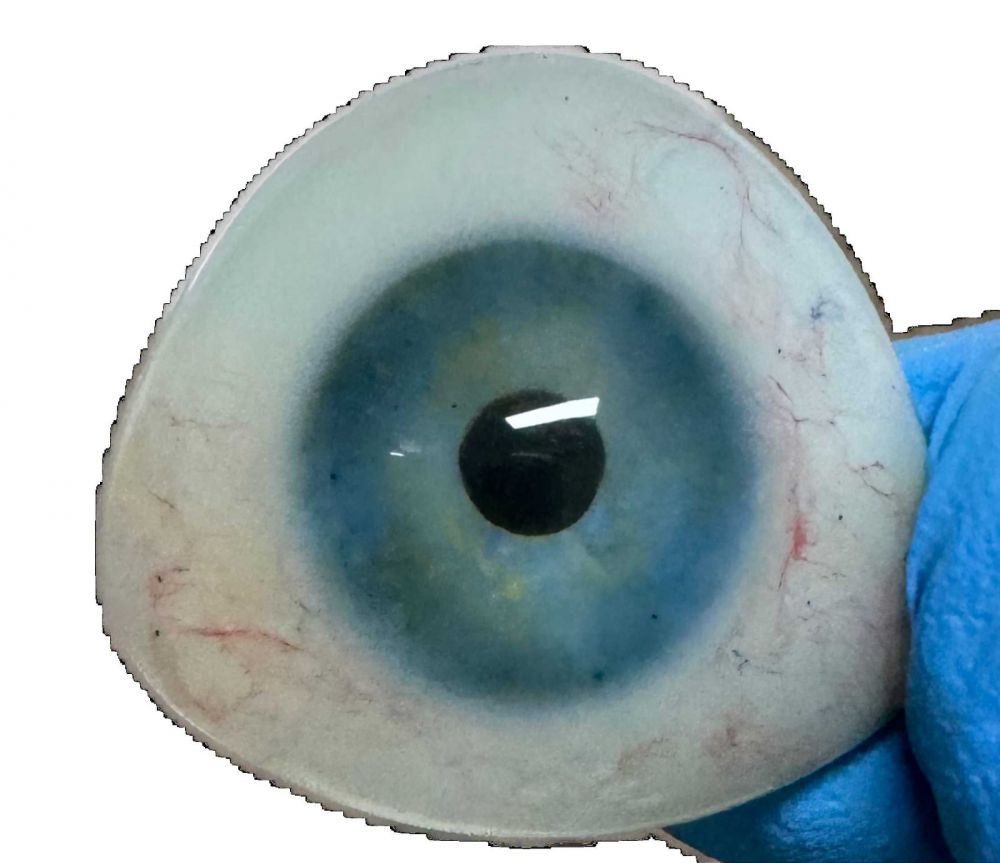 江山义眼假眼厂家